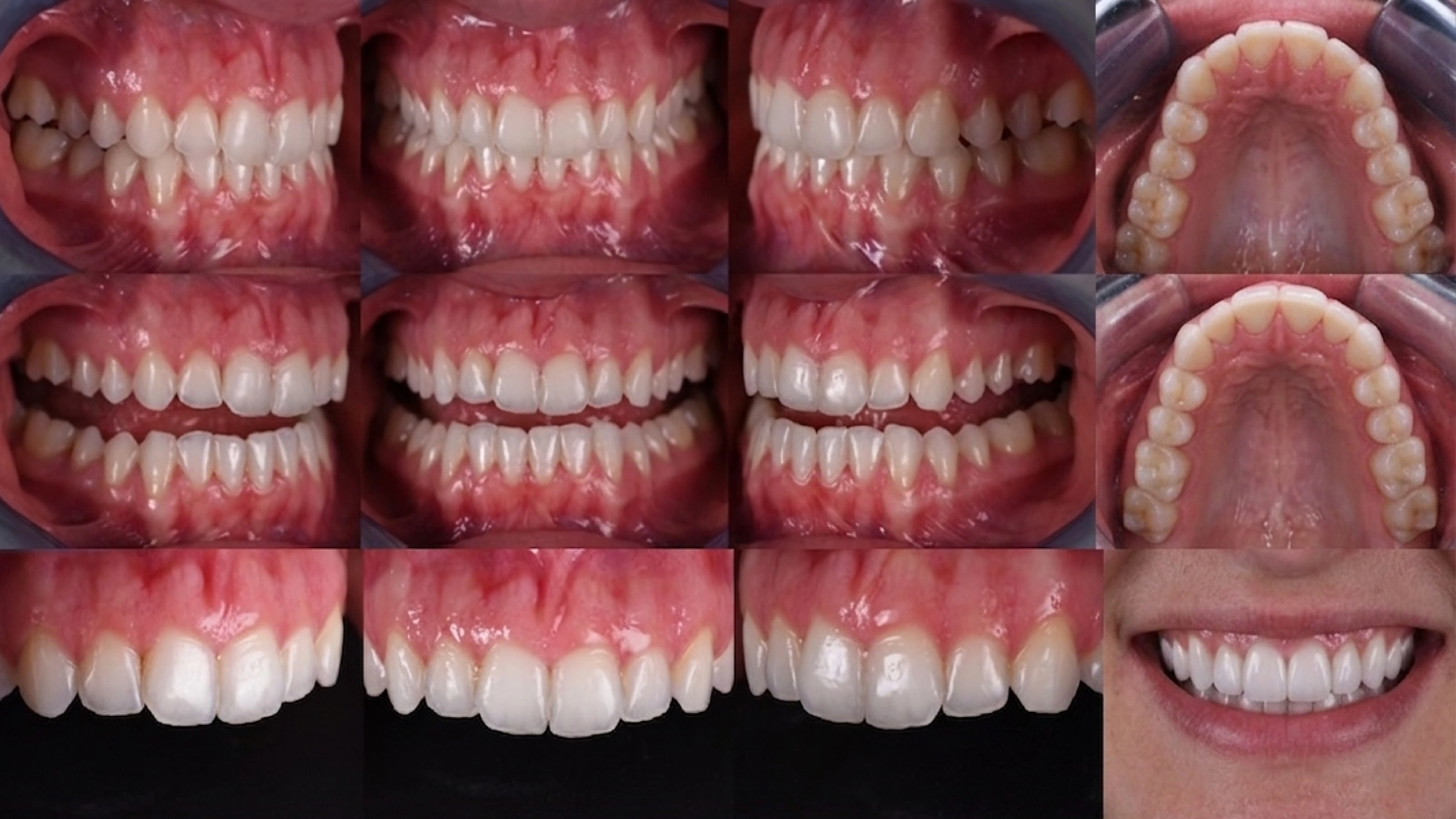 Dental photography