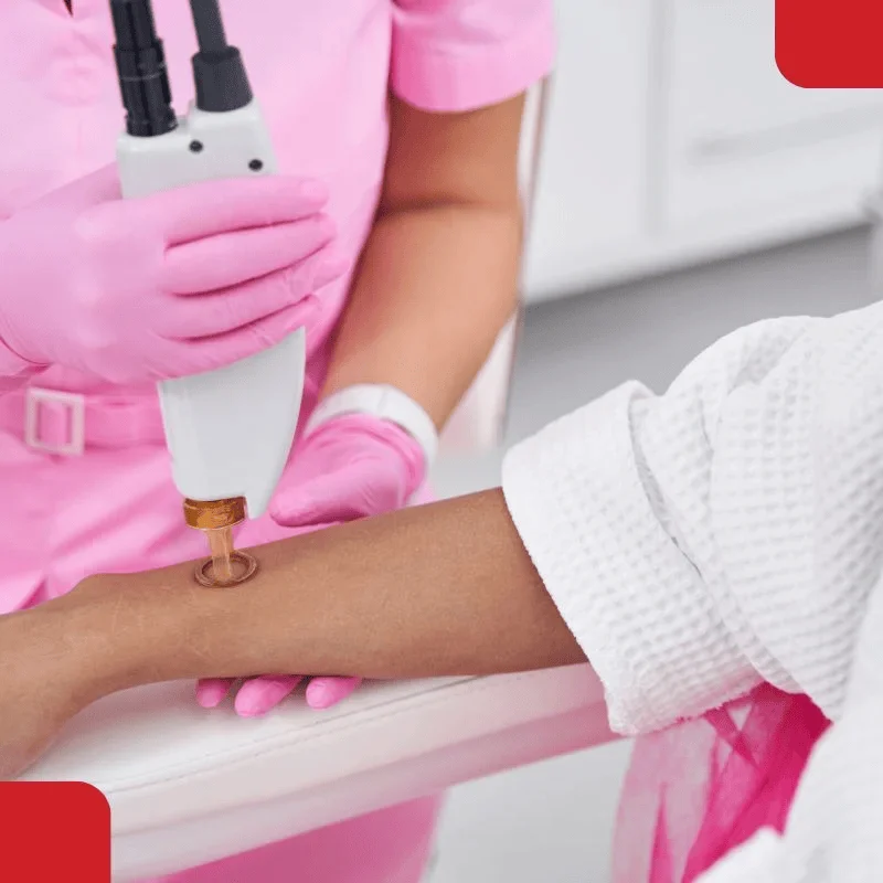 Diode Laser