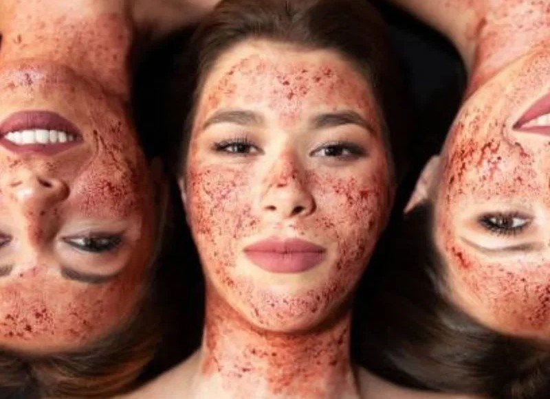 Face PRP treatment