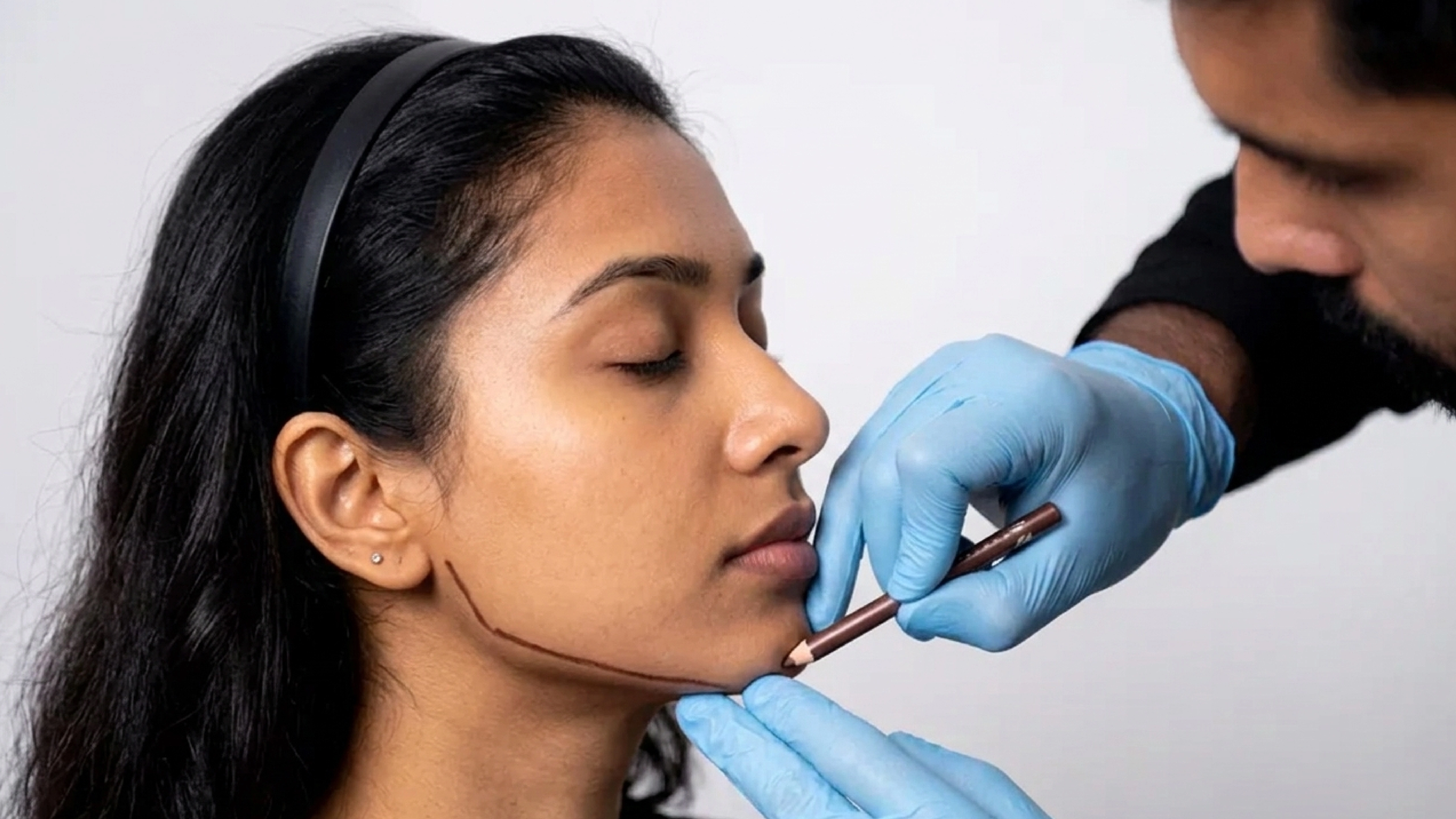 JawDefine Contour treatment