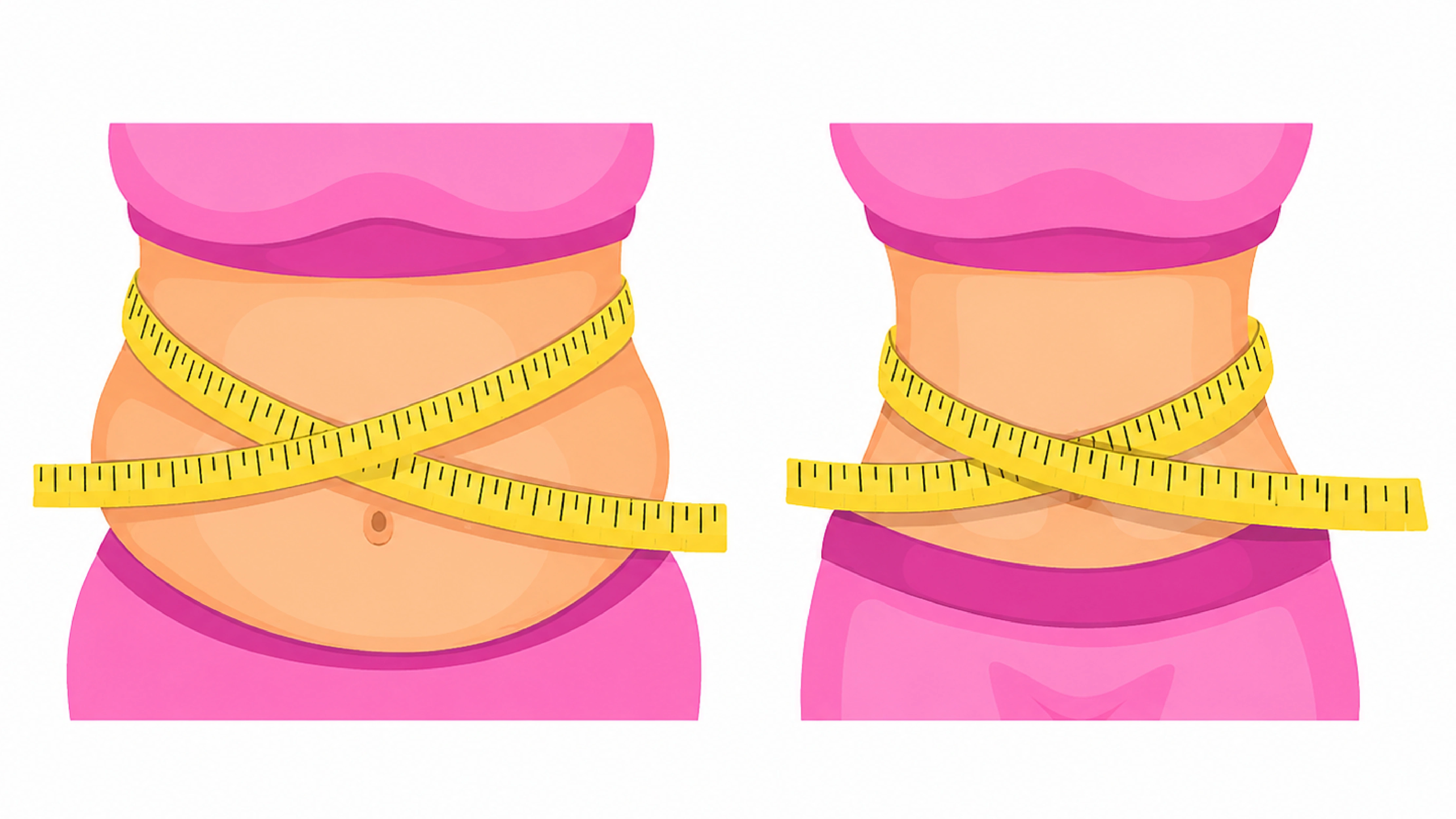 Laser-Assisted Liposuction