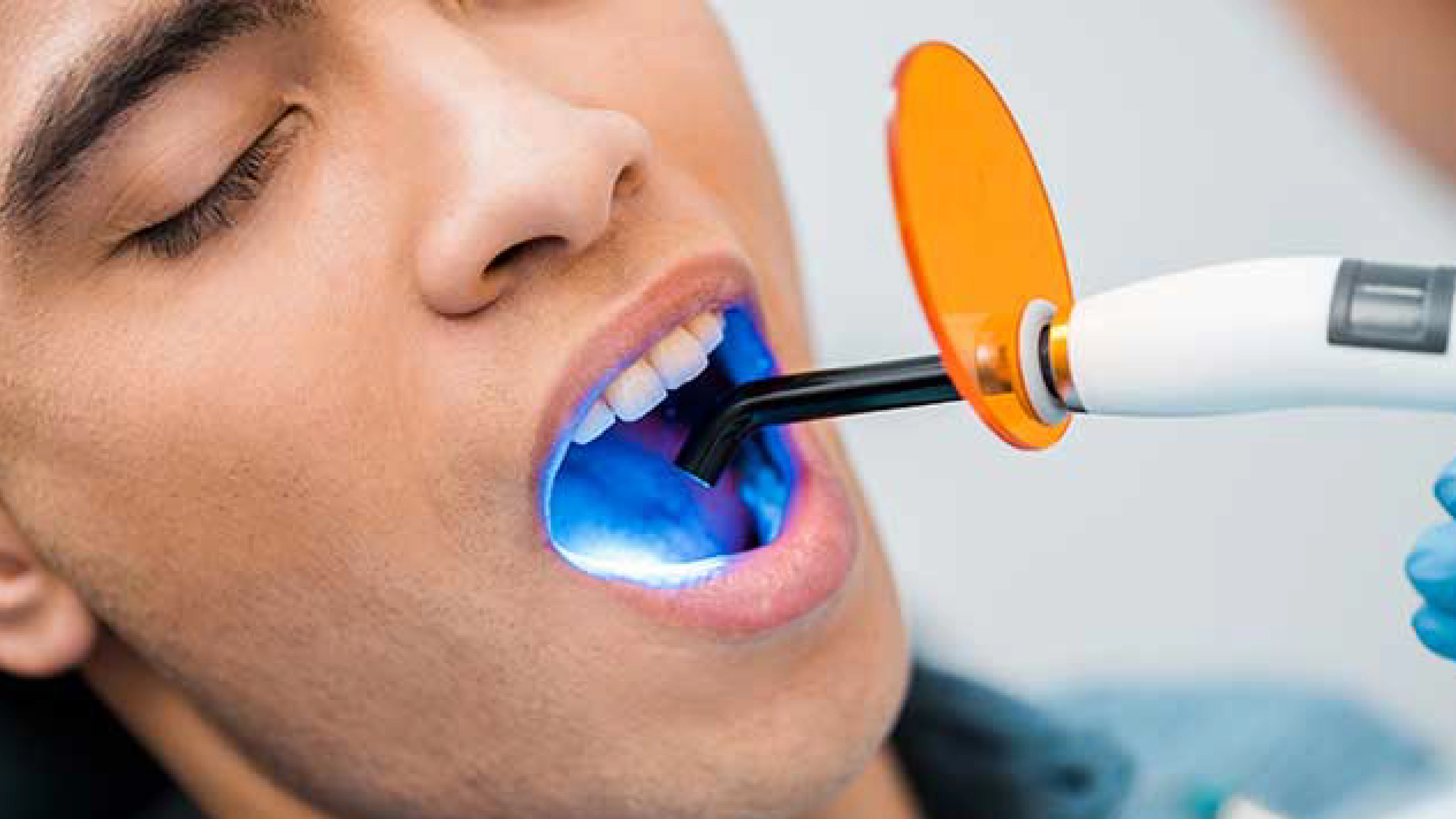 Laser dentistry