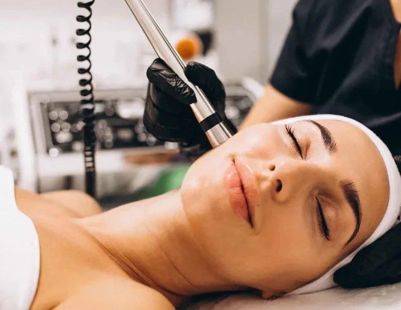 Microdermabrasion treatment