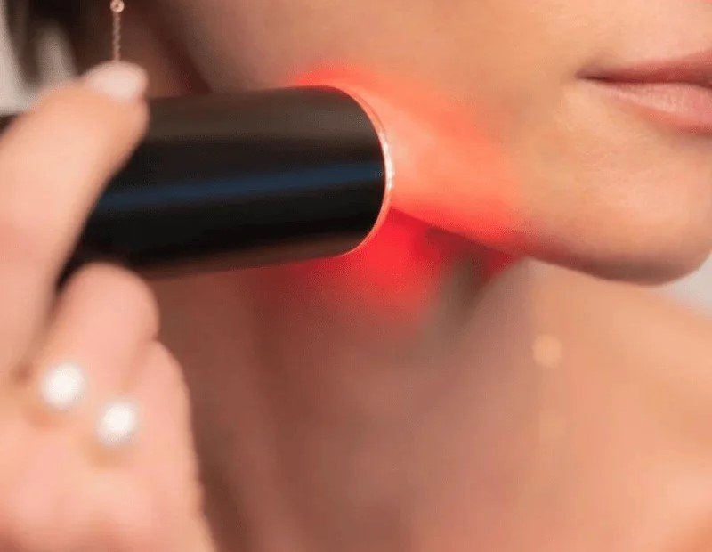 Q-Switched Laser Therapy treatment
