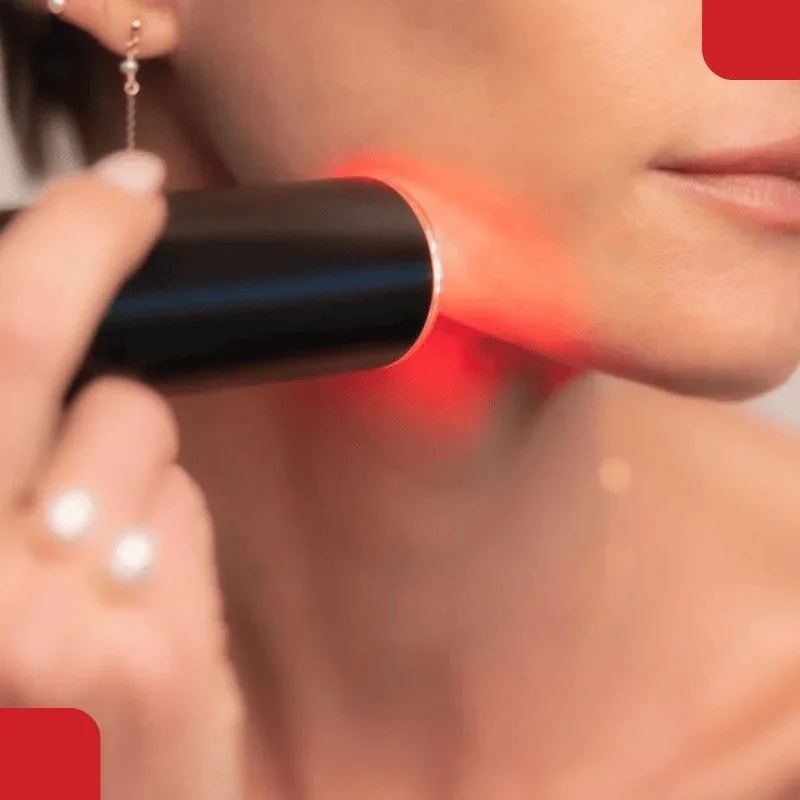 Q-switched laser treatment