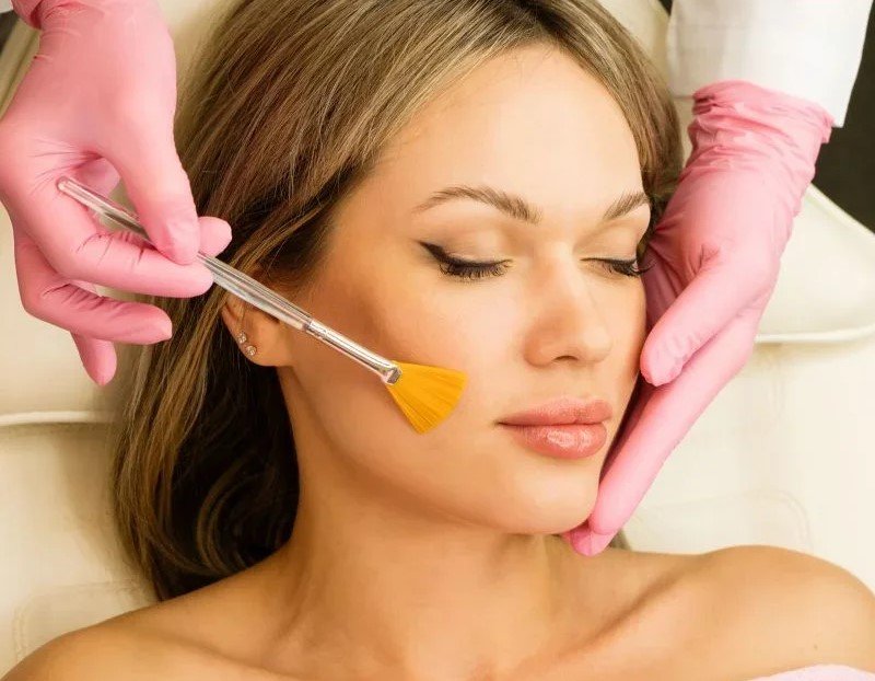 Skin peel treatment