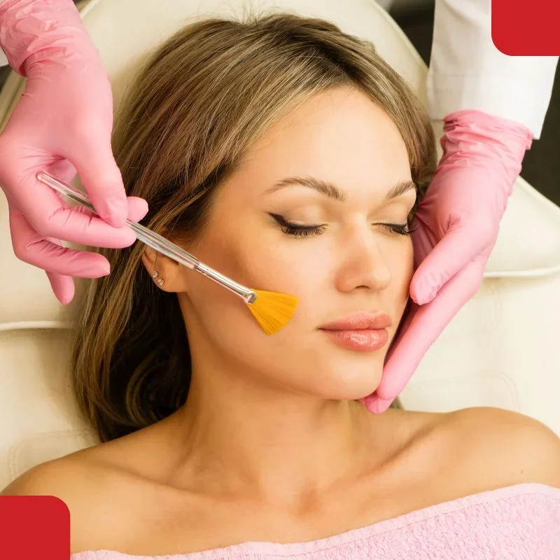 Skin peel treatment